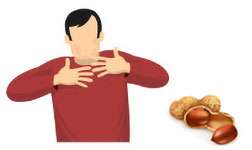 Allergies à la cacahuète